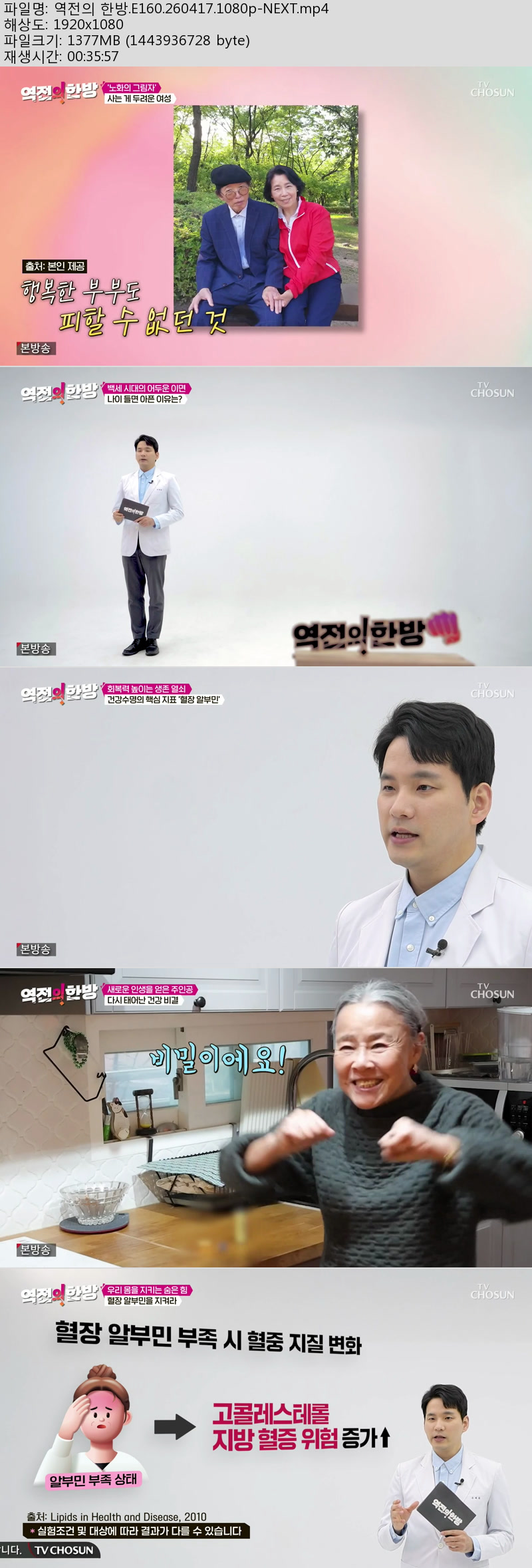 역전의 한방.E160.260417.1080p-NEXT