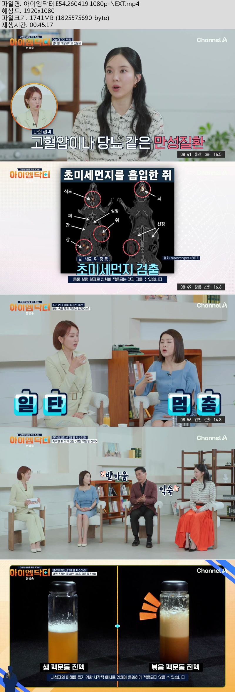 아이엠닥터.E54.260419.1080p-NEXT