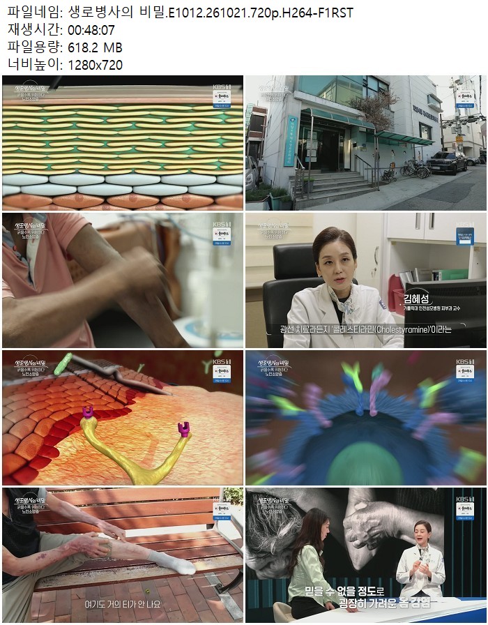 생로병사의 비밀.E1012.261021.720p.H264-F1RST